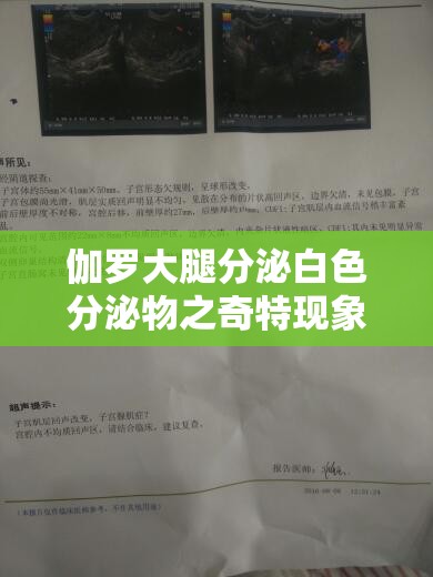 伽罗大腿分泌白色分泌物之奇特现象引发关注