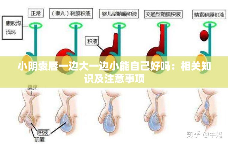 小阴囊唇一边大一边小能自己好吗：相关知识及注意事项