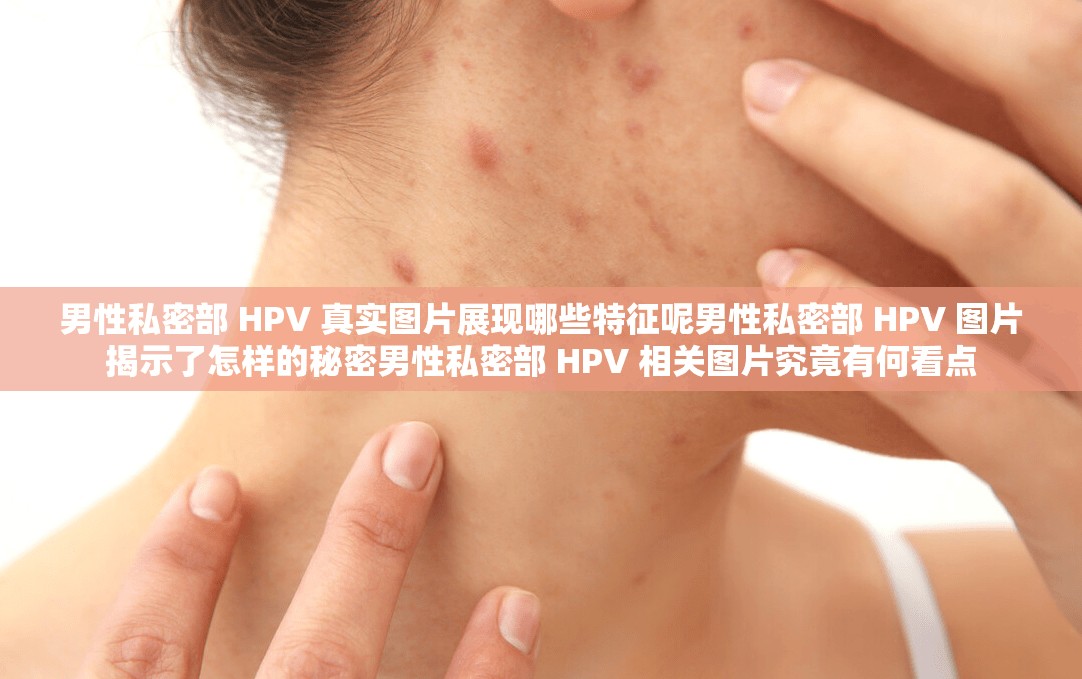 男性私密部 HPV 真实图片展现哪些特征呢男性私密部 HPV 图片揭示了怎样的秘密男性私密部 HPV 相关图片究竟有何看点